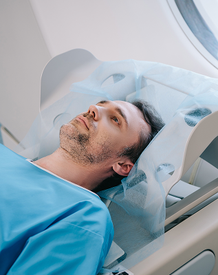 Intensity Modulated Radiotherapy (IMRT)