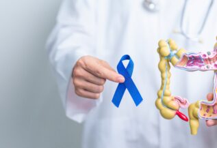 വൻകുടൽ അർബുദം: നേരത്തെ കണ്ടെത്താം, ജീവൻ രക്ഷിക്കാം!